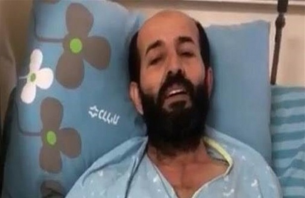 Filistinli Esrin Açlık Grevinin 80. Gününde: Özgürlük ve haysiyet için savaşıyorum