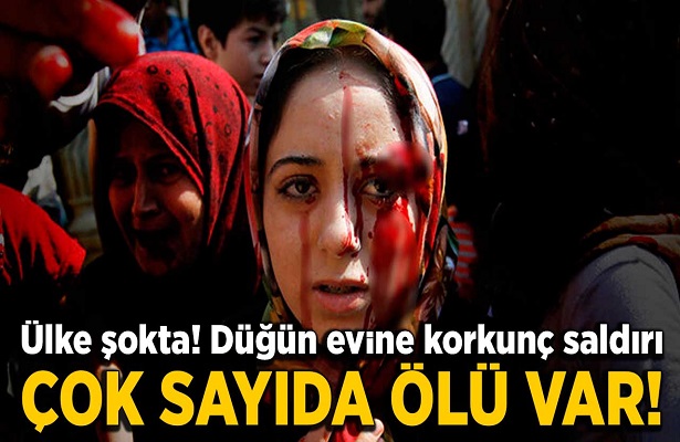 Husiler düğün salonuna saldırdı! Çok sayıda ölü ve yaralı var