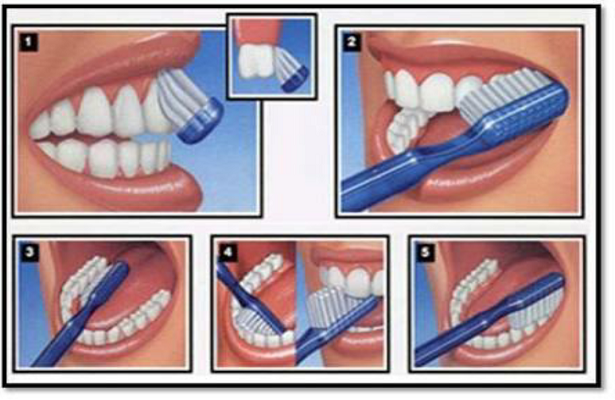 Doğru Diş Fırçalama Nasıl Yapılır