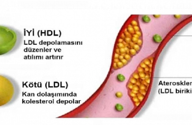 Kolesterol nedir? Belirtileri nelerdir?