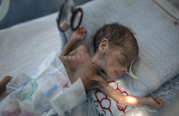 UNICEF: Yemen’deki savaş nedeniyle iki ayda 47 çocuk öldü veya yaralandı