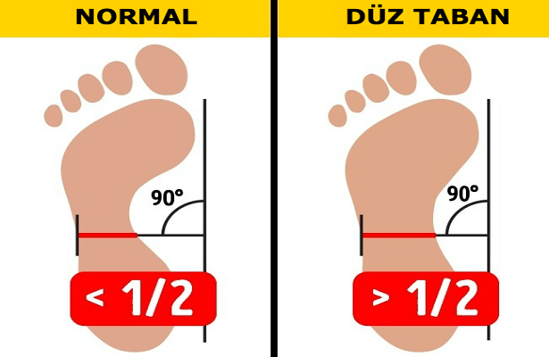 DÜZ TABAN OLUP OLMADIĞIMI EVDE NASIL ANLARIM?