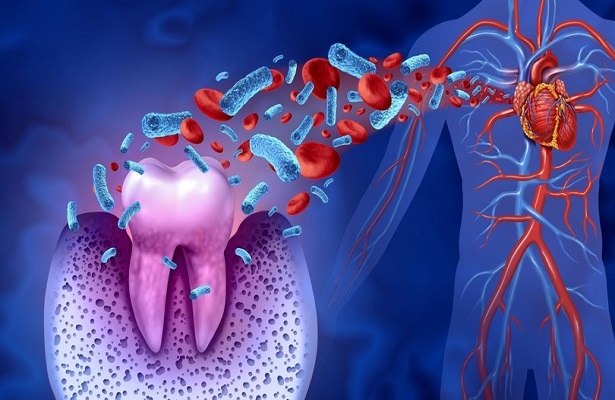 Dişteki çürük kalp sağlığını etkiler mi?