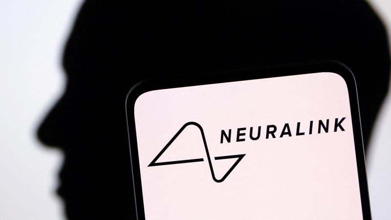 Elon Musk, Neuralink’in beyin çipinin ilk kez bir insana yerleştirildiğini duyurdu