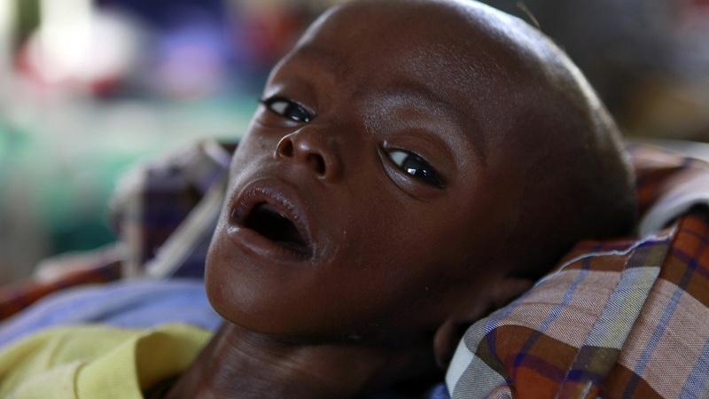 Fakir ülkelerden hemşirelerin göç etmesi / Batı’nın Afrika sağlık sistemi için yeni krizi