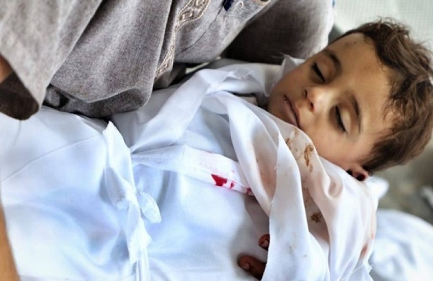 ABD’li Doktorun Gazze’de Çocuk Avına İlişkin Dehşet Verici Açıklaması!